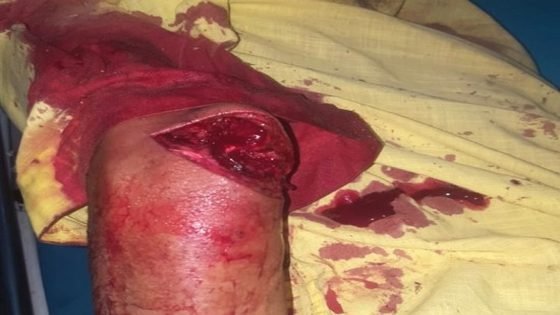 محاولة اختطاف فتاة قاصر وإحداث عاهة مستديمة بوالدها بقلعة السراغنة