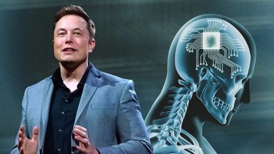 إعلان ماسك عن نجاح زرع شريحة دماغية في أول إنسان