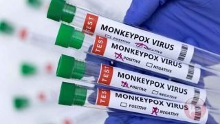 منظمة الصحة العالمية تؤكد إمكانية “السيطرة” على جدري القردة