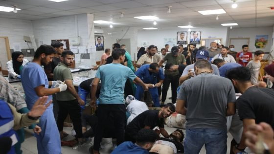 غـــــزة..مستشفى كمال عدوان يعلن توقف خدمات العمليات الجراحية