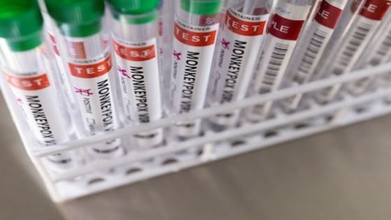 الصحة العالمية تؤكد أن جدري القردة لا يزال يمثل حالة طوارئ صحية عامة